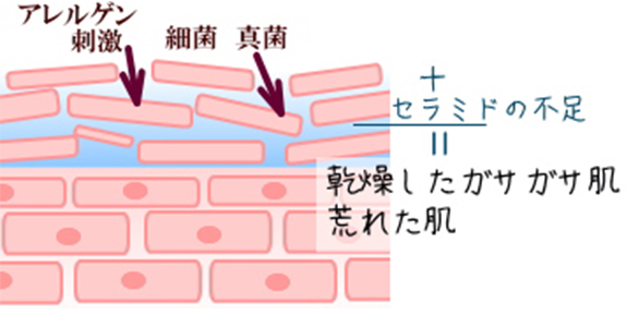 バリア機能を失った肌